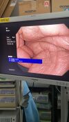 OLYMPUS GIF-HQ290 Gastroscope
