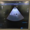 TOSHIBA PST-65AT Ultrasound Transducer