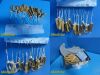 CODMAN Symmetry Duralook Fish Hook Neuro Elastic Retractor Set W/ Tray