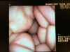 PENTAX VSB-3430 Enteroscope