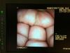 PENTAX VSB-3430 Enteroscope