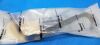 AESCULAP BT501R Retractor
