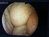 OLYMPUS GIF-XP20 Gastroscope