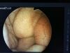 OLYMPUS GIF-XP20 Gastroscope