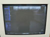 SIEMENS VF13-5 Ultrasound Transducer