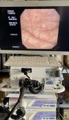 OLYMPUS CV-150 Endoscopy Processor