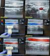 ACUSON 15L8W Linear Array Ultrasound Transducer