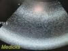 ACUSON 8C4 Convex Array Ultrasound Transducer