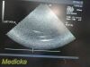 ACUSON 3V2C Phased Array Ultrasound Transducer