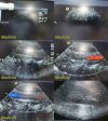 ACUSON 3V2C Phased Array Ultrasound Transducer