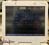 EDAN USA CardioTech SE 12 Express ECG with a Big Foldable Screen EKG