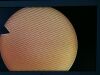 WELCH ALLYN FX-100 Sigmoidoscope