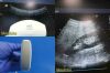 ACUSON Model 6C2 Convex Array Ultrasound Transducer Probe Ultrasound Transducer