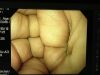 OLYMPUS GIF-H260 Gastroscope