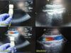ACUSON 8V5 Vector Array  Ultrasound Transducer