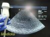 ACUSON 3V2C Vector Array Ultrasound Transducer
