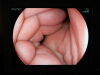 FUJINON EC-590ZP Colonoscope