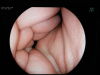 FUJINON EC-590MP Colonoscope