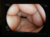 FUJINON EC-L590ZP Colonoscope