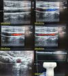 ACUSON 15L8W P/N 08241113 Linear Array Ultrasound Transducer