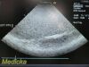 ACUSON 2011  4V1 P/N 08257869 Vector Array Ultrasound Transducer
