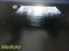 ACUSON 2013  4V1 Phased Array  Probe (08257869) Ultrasound Transducer