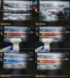 ACUSON 15L8W P/N 08241113 Linear Array Probe *GOOD COLOR FLOW* / Ultrasound Transducer