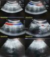 ACUSON 2009 Siemens Medical  8C4 Convex Array Ultrasound Transducer Probe Ultrasound Transducer