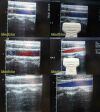 ACUSON Model 8L5 Linear Array Ultrasound Transducer Probe Ultrasound Transducer