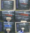 SIEMENS 2009  Sonoline Antares VF13-5 Linear Ultrasound Transducer