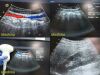 SIEMENS/ACUSON 6C2 Convex Array Ultrasound Transducer