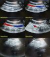 ACUSON 8C4 Convex Array Ultrasound transducer Probe *TESTED & WORKING* Ultrasound Transducer