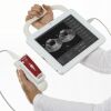 VITACON VitaScan PD Bladder Scanner Ultrasound - Urology