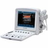 EDAN U50 Prime Diagnostic Ultrasounds