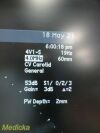 ACUSON 2009  Siemens 4V1 P/N 08257869 Sector Array Ultrasound Transducer