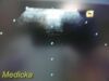 ACUSON 2012 Siemens  P/N 08257869 4V1 Phased Array Ultrasound Transducer