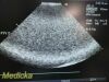 ACUSON 2012 Siemens  P/N 08257869 4V1 Phased Array Ultrasound Transducer