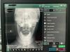 FUJIFILM FCR Prima T, Windows 10 FDX Workstation included. CR