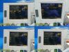 GE Corometrics 0128 120 Series , W/ 2X US; ToCO Trans~Maternal Fetal Fetal Monitor