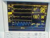 ACUSON 15L8 Ergo Linear Array Ultrasound Transducer