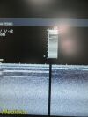 ACUSON 15L8 Ergo Linear Array Ultrasound Transducer