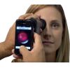 WELCH ALLYN iExaminer Ophthalmoscope Accessories