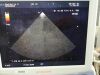 ALOKA UST-5296 Ultrasound Transducer