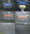 SIEMENS 2006  VFX13-5 (04838848) Linear Array Multi-D Ultrasound Transducer