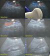 SIEMENS Sonoline Antares C5-2 Model 04839465 Convex Array Ultrasound Probe/ Ultrasound Transducer