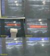 SIEMENS VFX13-5 Multi-D Linear Array Ultrasound Transducer