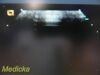 ACUSON 4V1 Vector Array Ultrasound Transducer