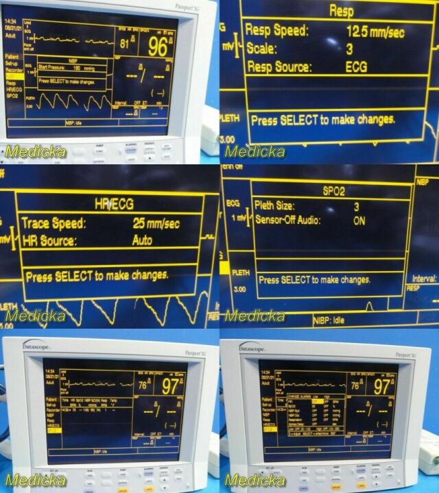 DATASCOPE Passport XG Patient Monitor