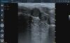 PLUSMED Q10 Vet. Ultrasound