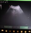 ESAOTE MyLab 30CV Portable Ultrasound Scanner